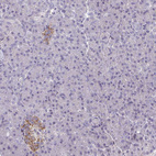 Anti-PSMG1 Antibody