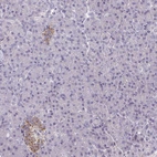Anti-PSMG1 Antibody