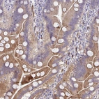 Immunohistochemical staining of human small intestine shows strong cytoplasmic positivity in glandular cells.