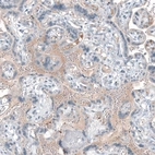 Immunohistochemical staining of human placenta shows moderate positivity in plasma.