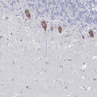 Immunohistochemical staining of human cerebellum shows strong granular cytoplasmic positivity in Purkinje cells.