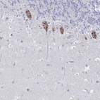 Anti-PSMG1 Antibody