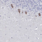 Immunohistochemical staining of human cerebellum shows strong granular cytoplasmic positivity in Purkinje cells.