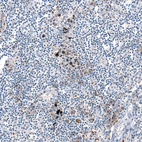 Anti-CXCL8 Antibody