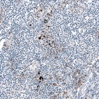 Immunohistochemical staining of human lymph node shows weak to moderate cytoplasmic positivity in a subset of non-germinal center cells.