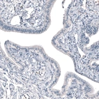 Immunohistochemical staining of human fallopian tube shows no positivity in glandular cells as expected.