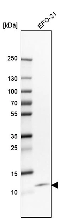 Western blot analysis in human cell line EFO-21.