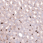 Anti-SLC18A2 Antibody