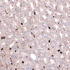 Immunohistochemical staining of human stomach shows strong cytoplasmic positivity in gastric endocrine cells.