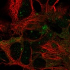 Anti-DYNC1LI2 Antibody