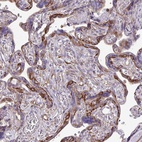 Anti-MYH10 Antibody