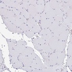 Immunohistochemical staining of human skeletal muscle shows low expression as expected.
