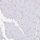 Anti-MYH10 Antibody