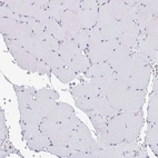 Immunohistochemical staining of human skeletal muscle shows low expression as expected.
