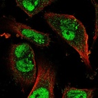 Anti-KDM3B Antibody