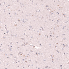 Immunohistochemical staining of human cerebral cortex shows positivity in single neural fibers, and no staining in neurons as expected.