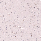 Immunohistochemical staining of human cerebral cortex shows positivity in single neural fibers, and no staining in neurons as expected.
