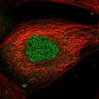 Anti-AMMECR1L Antibody