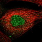 Immunofluorescent staining of human cell line A-431 shows localization to nucleus & cytosol.