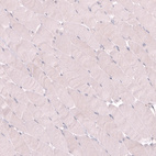 Immunohistochemical staining of human skeletal muscle shows no positivity in myocytes as expected.