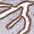 Immunohistochemical staining of human Fallopian tube shows strong membranous positivity in glandular cells.
