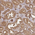 Immunohistochemical staining of human Kidney shows strong membranous and cytoplasmic positivity in cells in tubules.