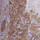 Immunohistochemical staining of human Tonsil shows moderate membranous and cytoplasmic positivity in squamous epithelial cells.