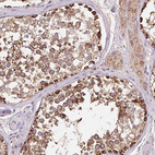 Immunohistochemical staining of human testis shows strong cytoplasmic positivity in cells in seminiferous ducts.