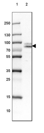 Lane 1: Marker [kDa] 250, 130, 100, 70, 55, 35, 25, 15, 10_br/_Lane 2: Human Adrenal Gland tissue