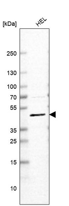 Anti-SLC18A2 Antibody