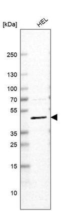 Western blot analysis in human cell line HEL.