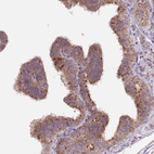 Anti-DGUOK Antibody