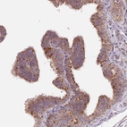 Immunohistochemical staining of human fallopian tube shows strong cytoplasmic granular positivity in glandular cells.