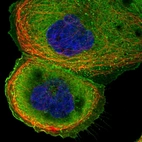 Immunofluorescent staining of human cell line A-431 shows localization to plasma membrane & vesicles.