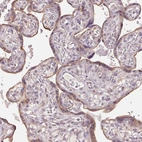 Immunohistochemical staining of human placenta shows moderate cytoplasmic positivity in trophoblastic cells.