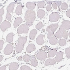 Immunohistochemical staining of human skeletal muscle shows no positivity in myocytes as expected.