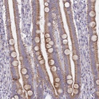 Anti-MRPS2 Antibody