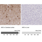 Anti-AK5 Antibody