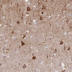 Immunohistochemical staining of human cerebral cortex shows high expression.