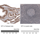 Anti-WT1 Antibody