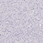 Immunohistochemical staining of human liver shows low expression as expected.