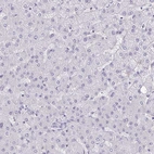 Immunohistochemical staining of human liver shows low expression as expected.