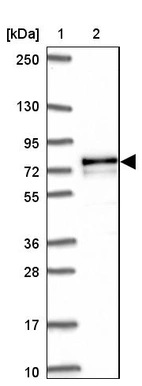 Lane 1: Marker [kDa] 250, 130, 95, 72, 55, 36, 28, 17, 10_br/_Lane 2: Human cell line RT-4