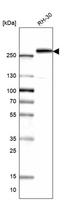 Anti-CAD Antibody