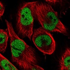 Immunofluorescent staining of human cell line U-251 MG shows localization to nucleoplasm.