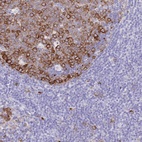 Anti-RRM1 Antibody