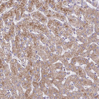 Immunohistochemical staining of human liver shows moderate granular cytoplasmic positivity in hepatocytes.