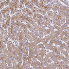 Anti-SARDH Antibody