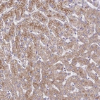 Immunohistochemical staining of human liver shows moderate granular cytoplasmic positivity in hepatocytes.