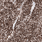 Anti-WT1 Antibody